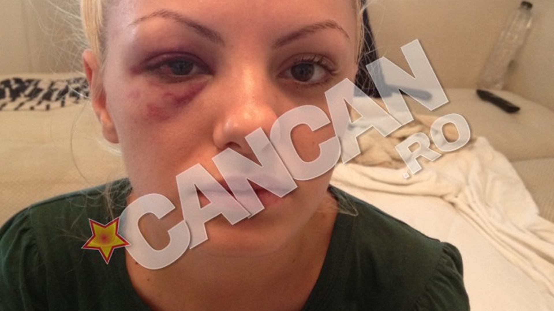 Alexandra Stan, despre cosmarul provocat de manager: “M-a batut pana am lesinat, apoi m-a aruncat din masina, plina de sange!”