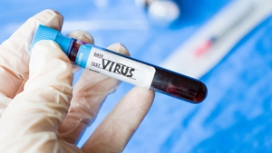 Virus transmis de rozătoare! Ce este hantavirusul și cât de periculos poate deveni