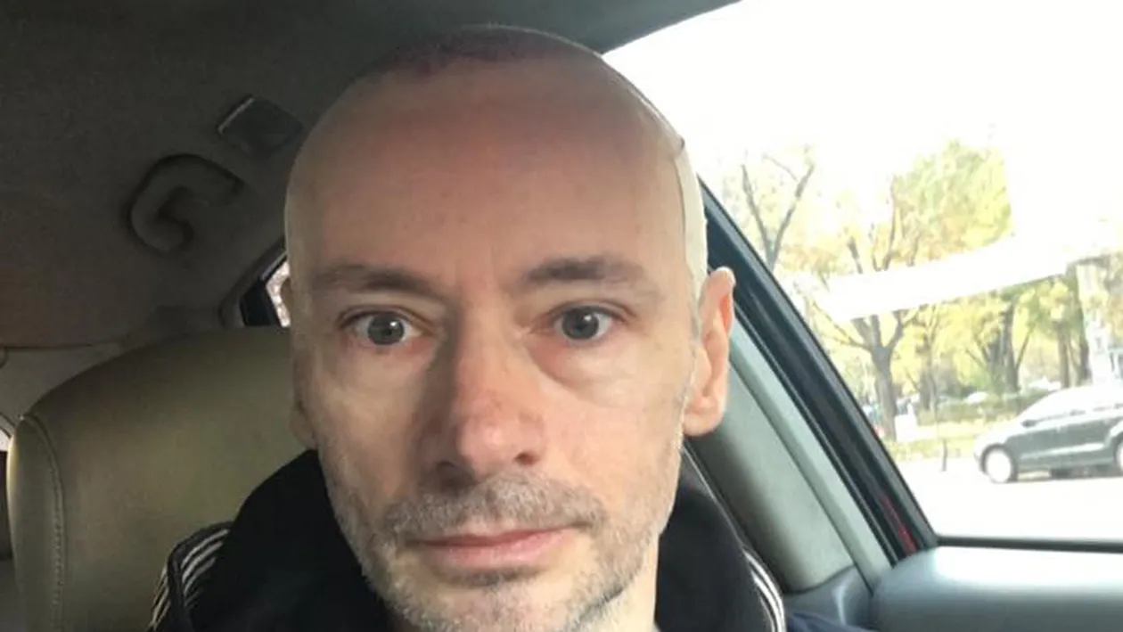 MIHAI ALBU, probleme în urma implantului de păr? Designerul a mărturisit:,,E buba PE cap’’