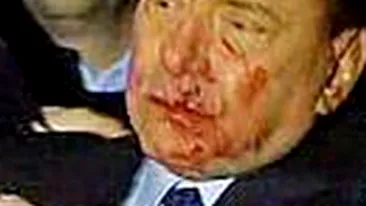 Si-a inscenat Berlusconi atacul?