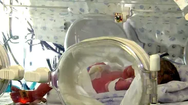 Caz unic în istoria omenirii: S-a născut primul bebeșul fără chip