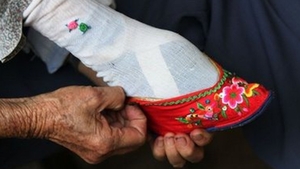 Ea este singura femeie din lume care mai are picioarele ASA! A fost mutilată pentru a arăta ca o păpusă! Imagini SOCANTE