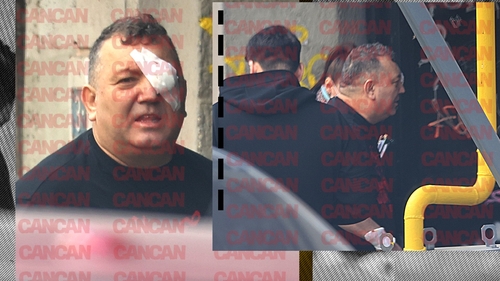 Primele & singurele imagini cu faimosul Beinur după ce a fost împușcat!