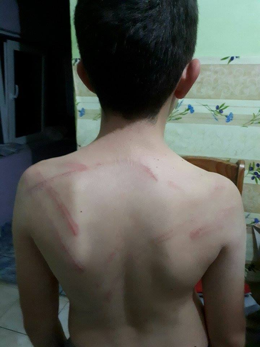 Copilul a fost bătut cu cruzime de tatăl său