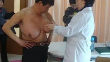 VEZI AICI cum arata barbatul cu sanii cat doua mingi de fotbal