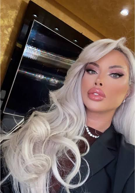 Loredana Chivu nu are liniște nici la ani distanță de la momentul injectării cu aqua filling