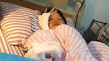 VIDEO / Un copil de 12 ani a fost mutilat după ce telefonul i-a explodat! Cum arată acum şi ce au găsit medicii pe trupul lui
