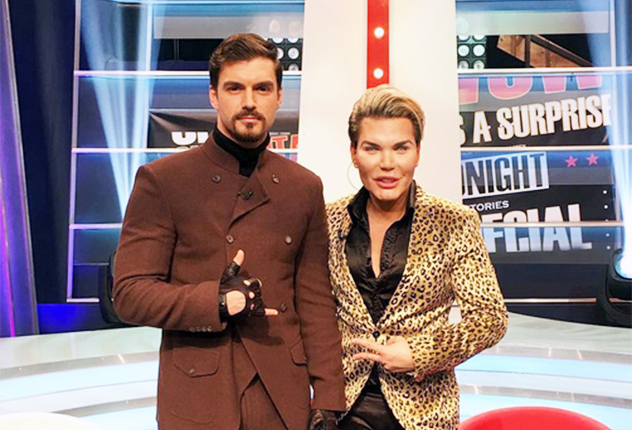 Transformare uluitoare a lui Rodrigo Alves! Cum arată acum „Păpuşa umană” Ken