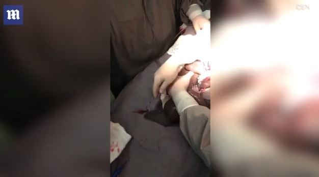 Imagini emoționante în sala de operații: un băiețel s-a născut în timp ce era încă în sacul amniotic. Cazul este foarte rar: 1 la 80.000 de nașteri | FOTO & VIDEO