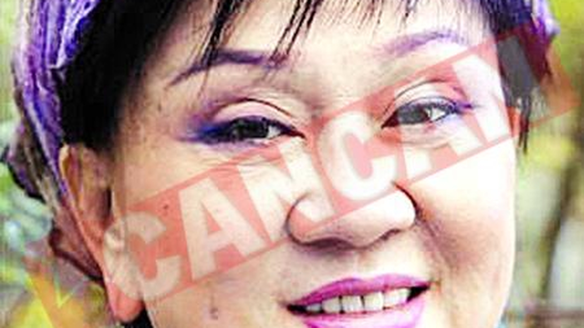A facut peste 50 de operatii estetice