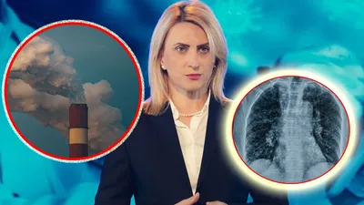 Mahler, avertisment dur pentru români: „Ni se pare normal să ne sufocăm pe stradă”