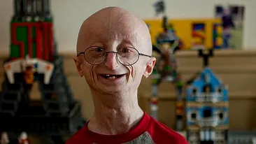 A murit tanarul care suferea de o boala cumplita! Sam Berns avea doar 17 ani, dar arata ca un BATRAN!