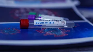 Teste diagnostic și anticorpi COVID-19. Cum afli dacă ești infectat sau dacă ai avut infecția în trecut 