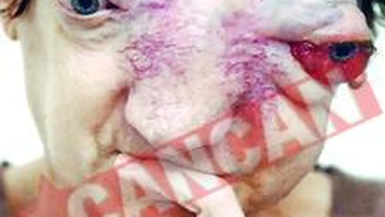 Emigreaza din Franta ca sa poata sa moara