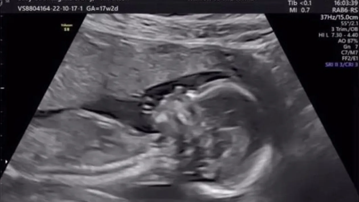 Telespectatorilor nu le-a venit să creadă! Fosta concurentă de la „Insula Iubirii” este însărcinată