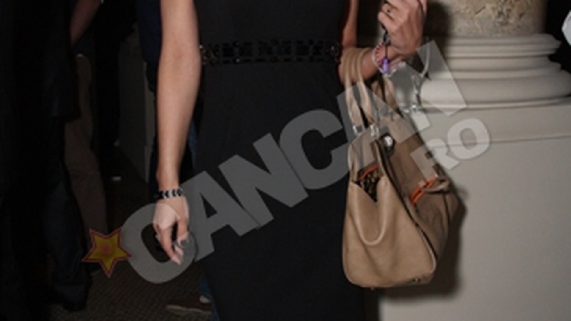 Sandra Stoicescu are boala "picioarelor umflate"