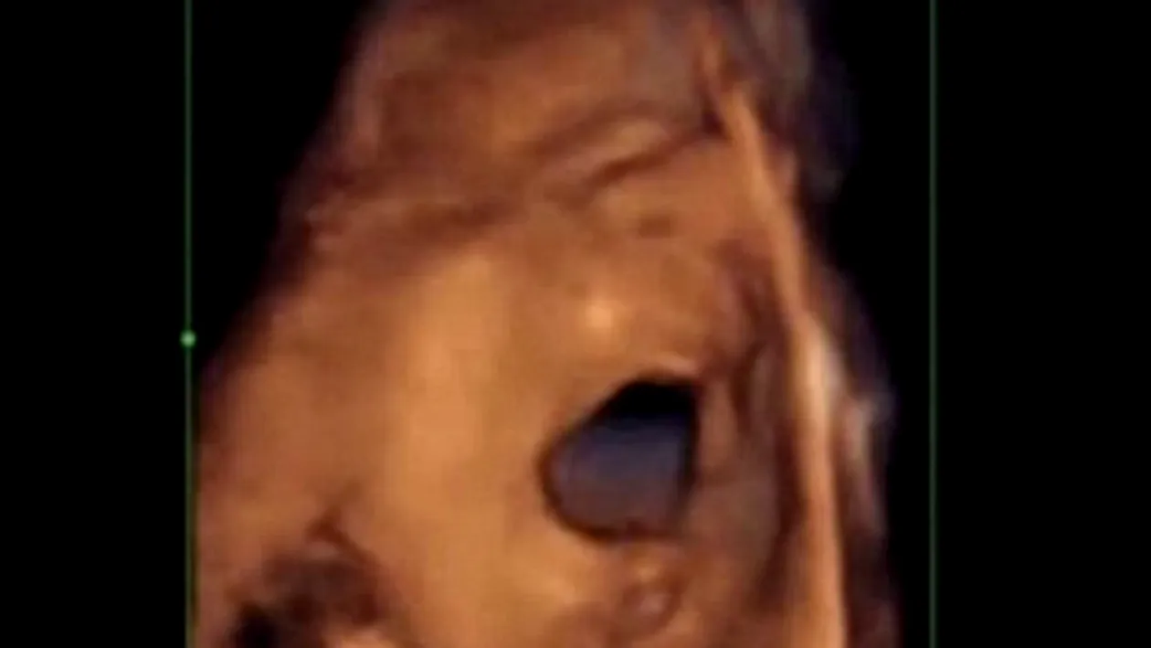 Vei fi emotionat pana la lacrimi! Imagine incredibile cu bebelusii care canta si danseaza in uterul mamei!