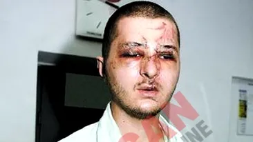 Au batut un om intr-un restaurant si nu pot fi identificati