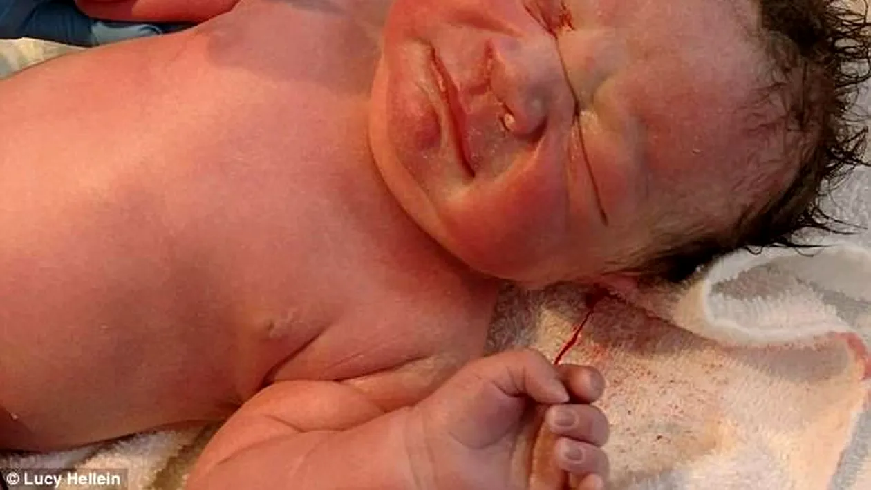 Ironia sorţii! Ce ţine bebeluşul în mână, la naştere! Medicii au fost şocati şi poza a fost distribuită de 70.000 de ori pe Facebook