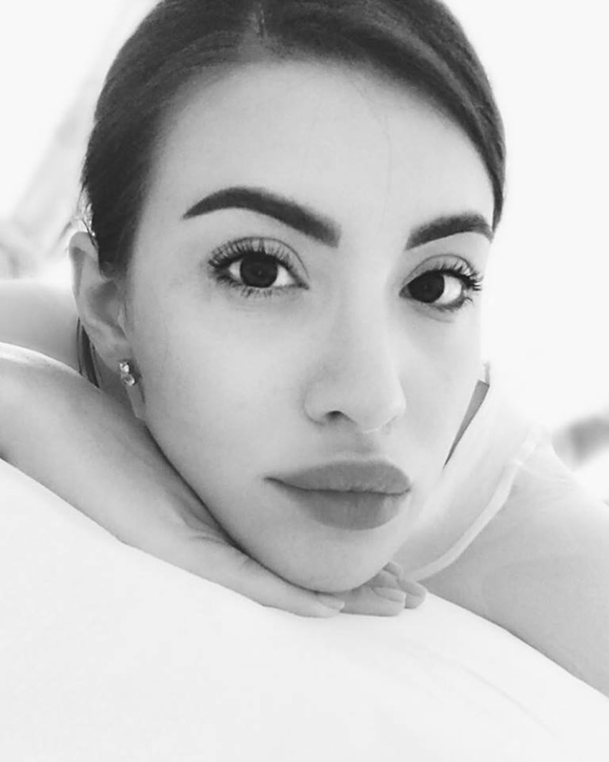 Nicoleta Nucă vrea să scape de un semn de la naștere: ”Am început o procedură cu laser”