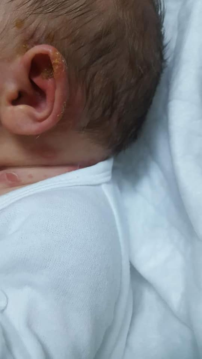 Rănile bebelușului s-au extins de la ureche