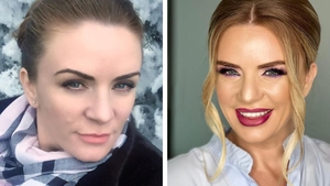 N-o recunoșteai pe stradă! Cum arăta Marcela Fota, înainte să apeleze la medicul estetician