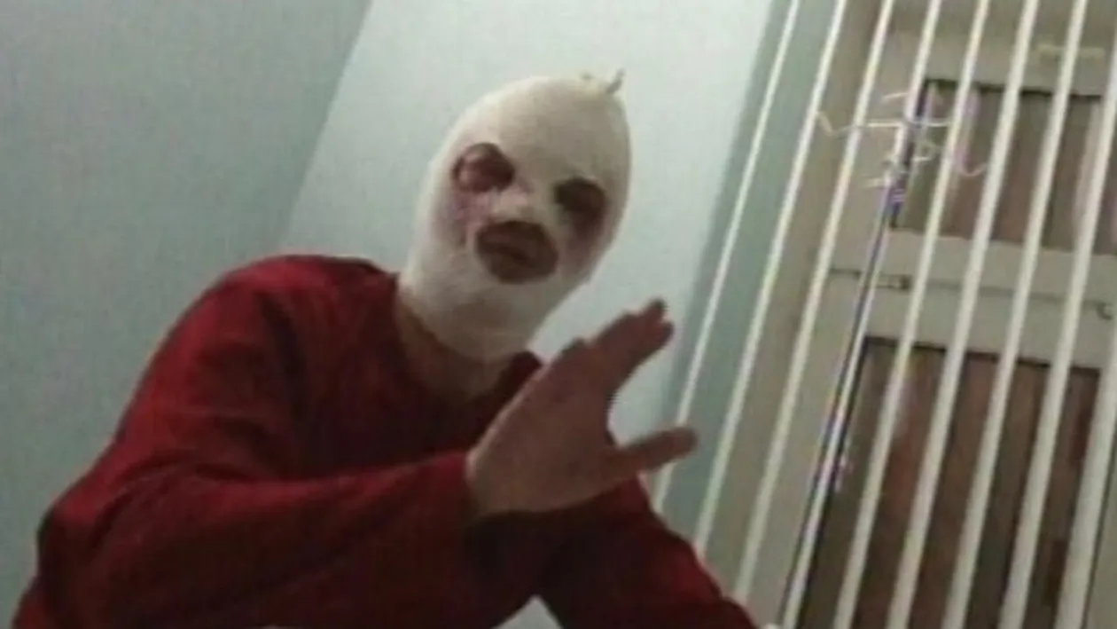 Unul dintre cei mai buni balerini din lume, atacat cu acid după ce a primit ameninţări cu moartea! Uite ce faţă frumoasă avea!