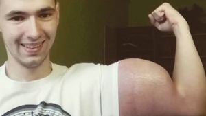 S-a injectat cu o substanţă controversată pentru a avea bicepşi de 60 de cm:”Simţeam că mor în pat...“