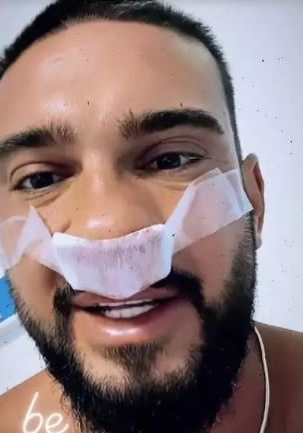 Dorian Popa, primele declarații de pe patul de spital, după ce s-a operat la nas. “A rămas la fel de mare, abia aștept să văd cum respir”