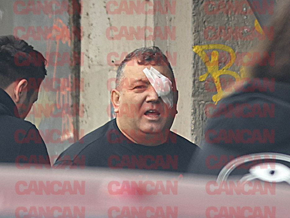 Nuredin Beinur, după ce a primit îngrijiri medicale (Foto: CANCAN.RO)