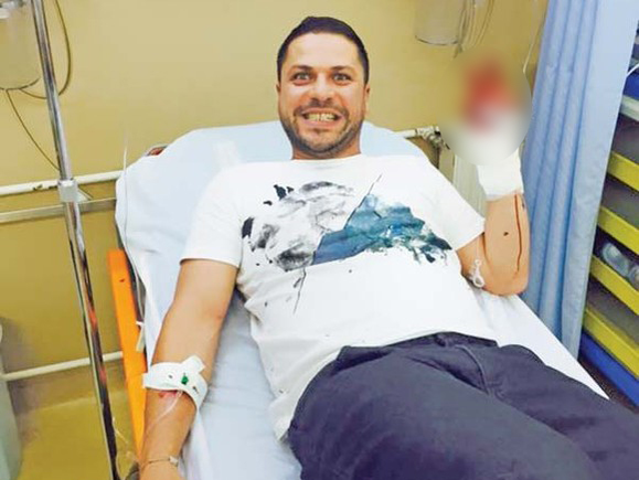 Augustin Viziru şi-a tăiat mâna la ''Ferma vedetelor''
