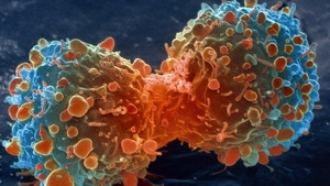Atentie, romani! Ce se poate intampla daca bei apa de la robinet! Specialistii avertizeaza: "CANCER!"