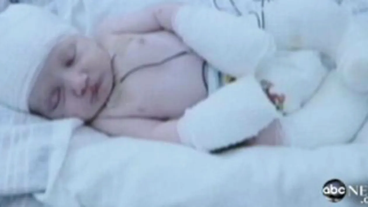 VIDEO Un bebelus s-a nascut fara piele! Medicii aproape ca ii puteau vedea creierul