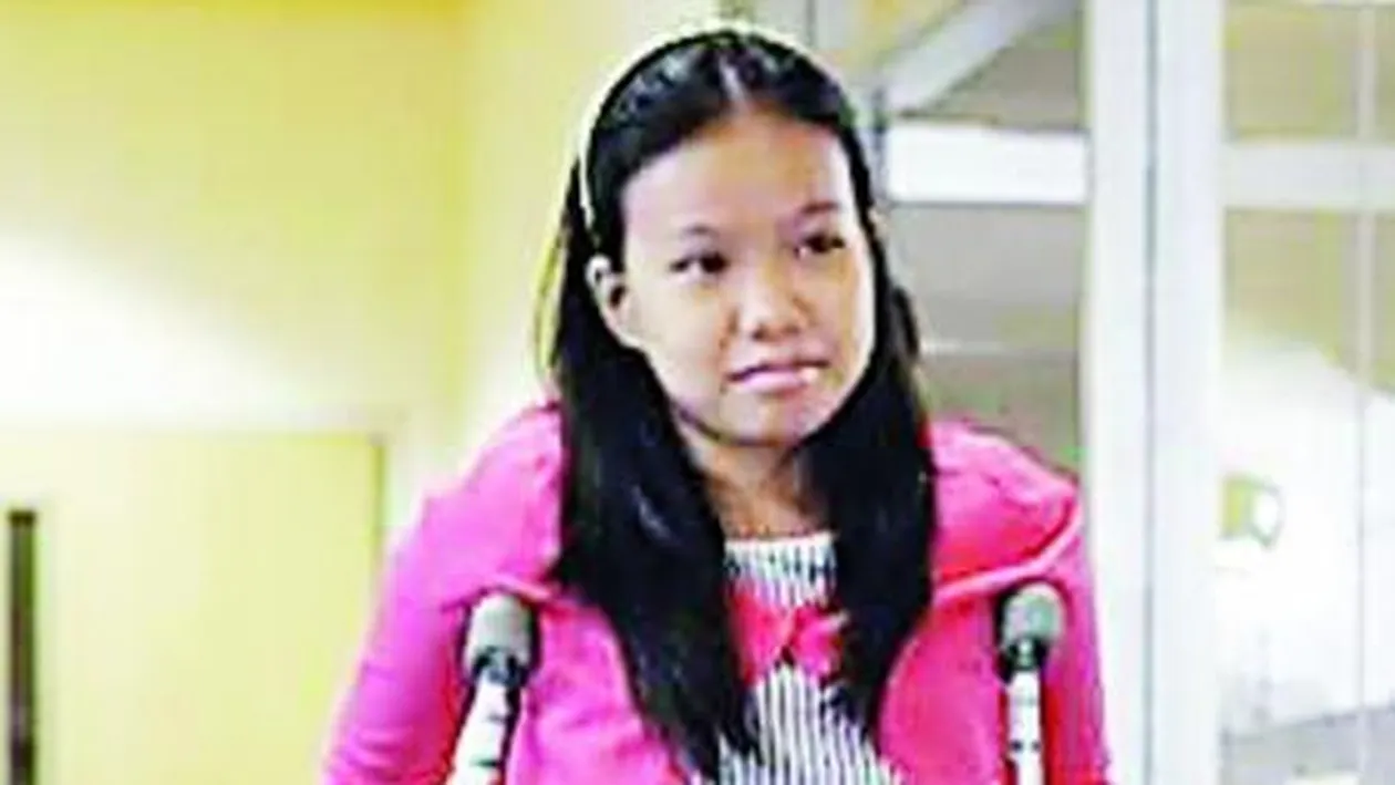 S-a nascut cu picioarele la spate