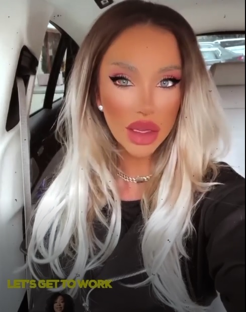 Cum arată Bianca Drăgușanu după operația de rinoplastie: ”Mă obsedează acest cheag cu sânge”