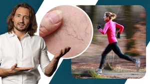 „Nu putem trata problemele venoase fără mișcare!” Dr. Cezar explică de ce activitatea fizică este esențială pentru circulatia sanguină