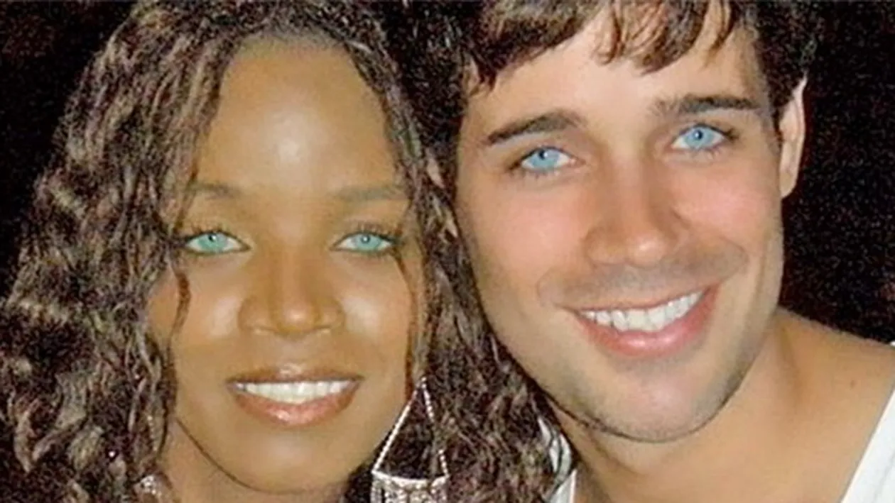 A platit 8.000 de dolari sa isi schimbe culoarea ochilor din caprui in verde deschis! Ce s-a intamplat la scurt timp dupa operatie