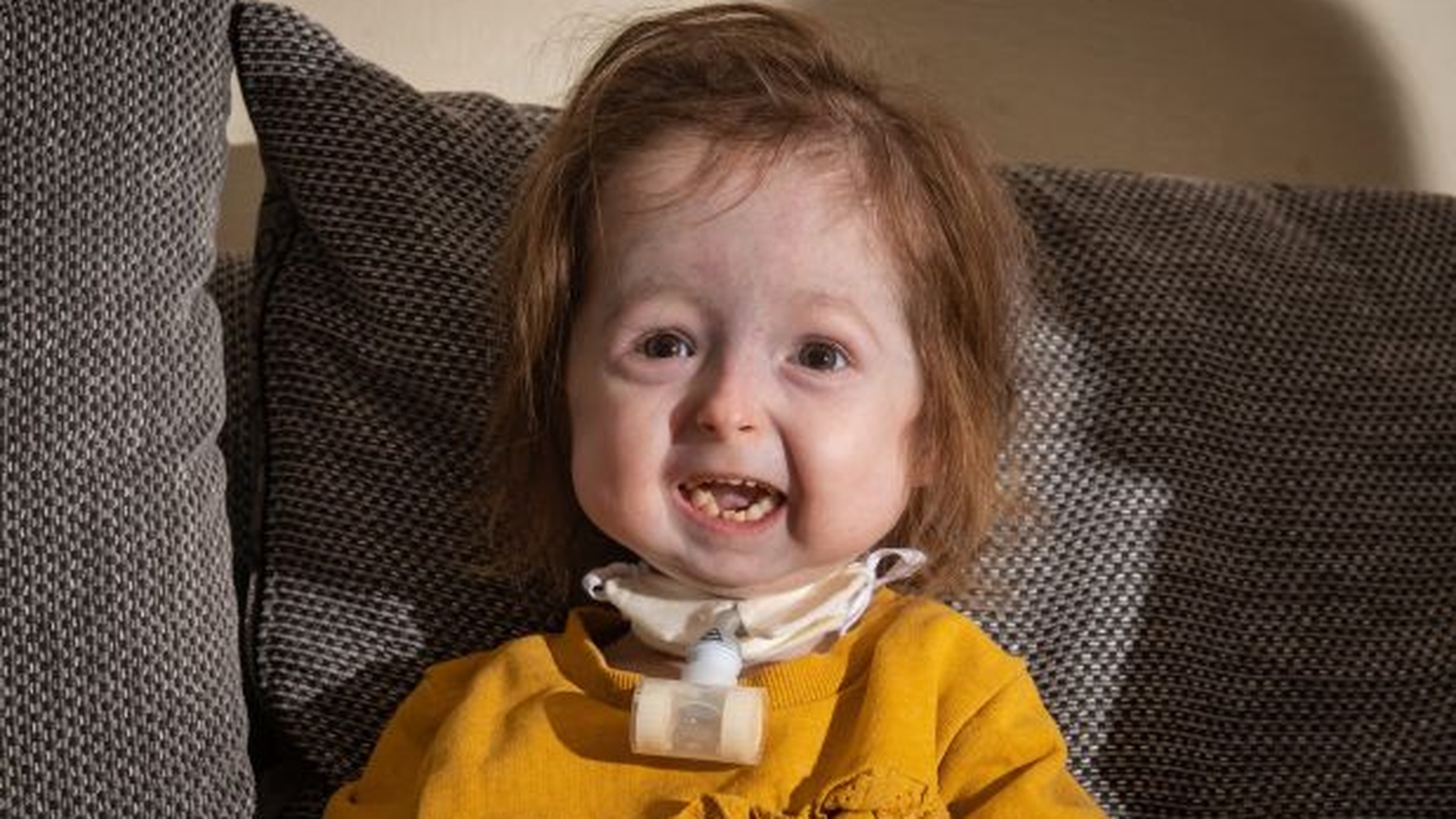 Fetiță de doi ani, singurul pacient din lume cu boala prezentată în filmul "Benjamin Button"