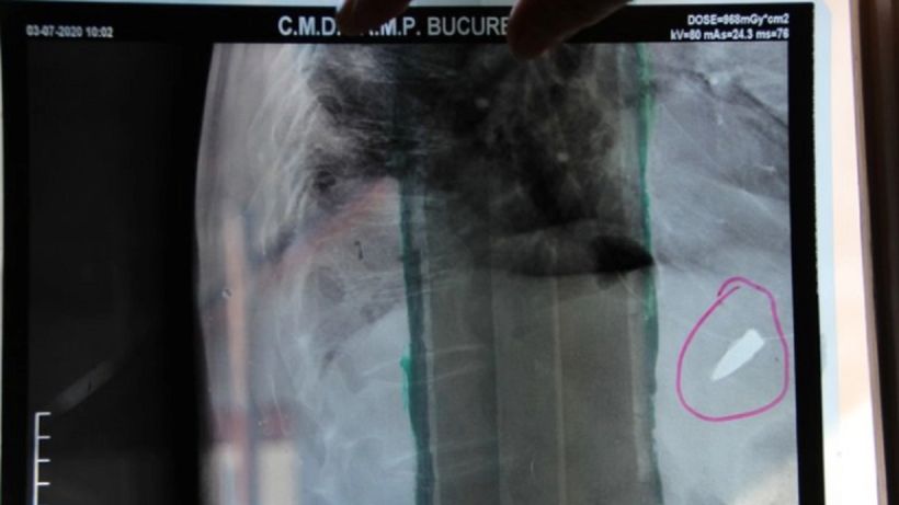 El este românul care trăiește de 80 de ani cu un glonț lângă inimă. Povestea care a făcut înconjurul lumii