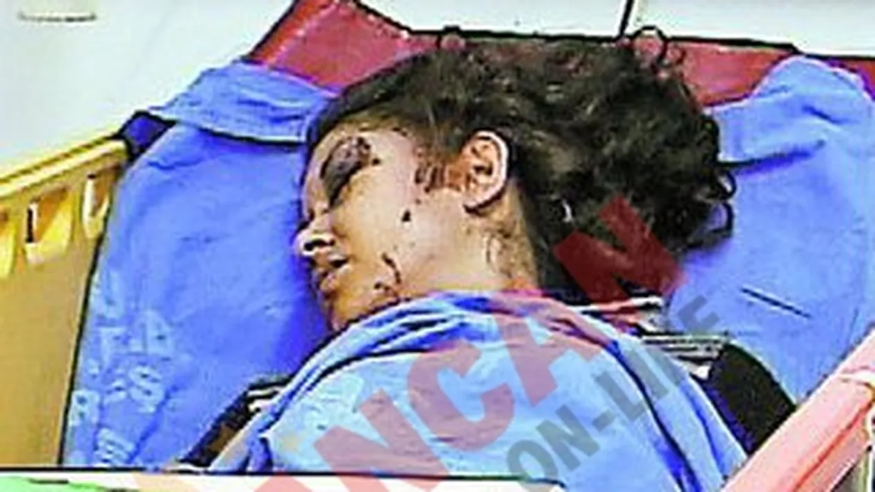 Batuta cu ciocanul de camatari