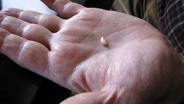 Este incredibil ce a putut sa pateasca un barbat de 70 de ani din Romania care a luat o pastila pentru potenta