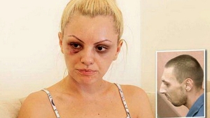 Alexandra Stan a dat uitării bătaia primită de la Marcel Prodan: "Sunt un om nou"