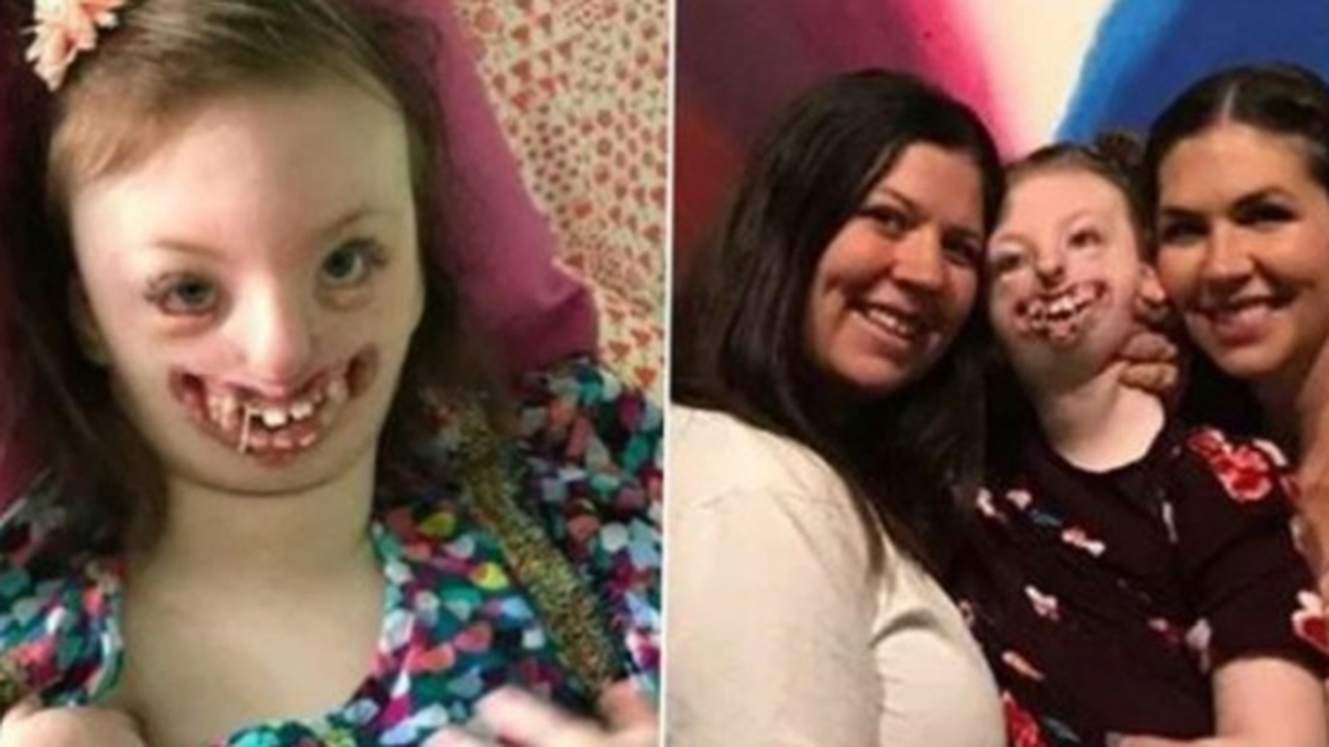Sophia, fetița desfigurată de boala Rett și pe care unii „internauți” au batjocorit-o, a murit la vârsta de 10 ani