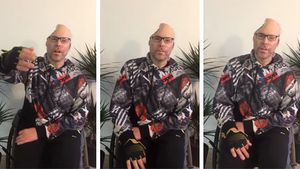 Rapper-ul Dr Knarf, paralizat și mutilat și pe viață. Primele imagini după ce medicii i-au îndepărtat jumătate din cap în urma exploziei produsă la un laborator de droguri