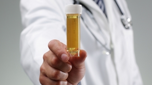 Un baschetbalist a fost suspendat după ce testul antidoping a arătat că e... gravid