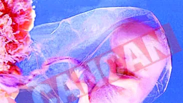 Isi vinde ovulele din cauza crizei