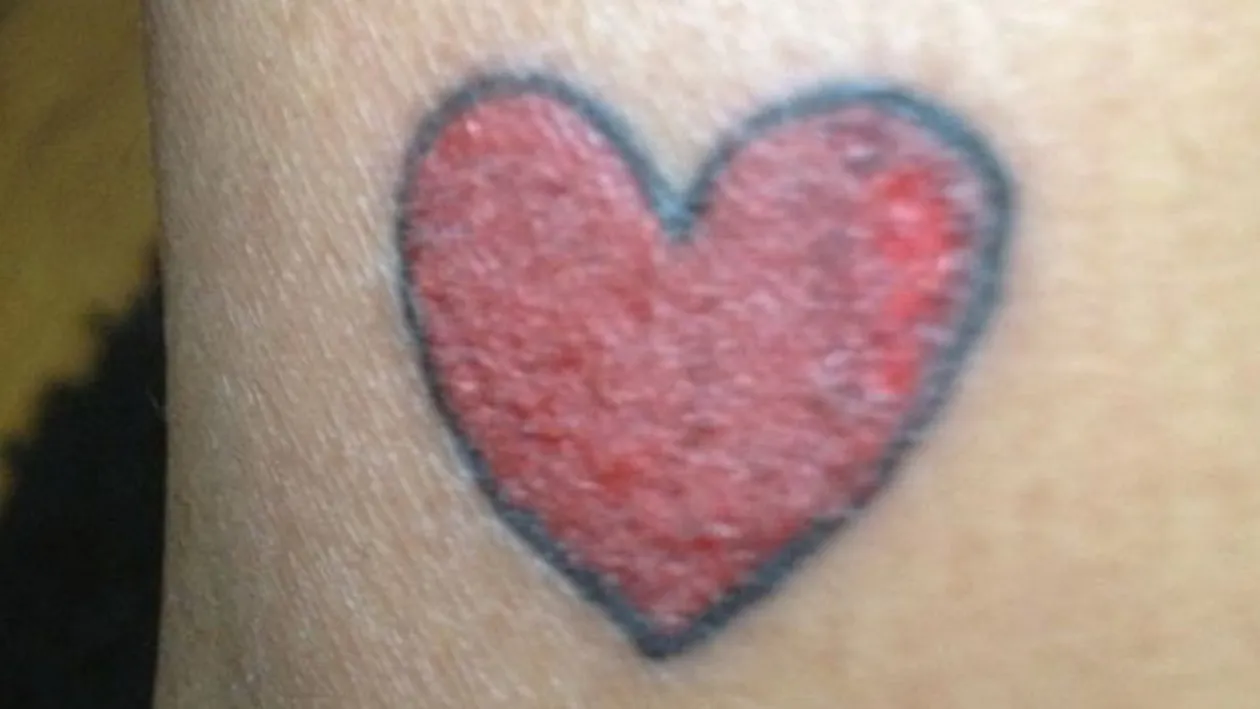 IMAGINI SOCANTE! Si-a facut un banal tatuaj, in forma de INIMA. Ce s-a intampla dupa cateva saptamani este INGROZITOR!