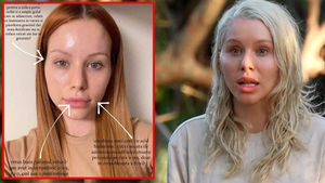 Cum arăta Carmen Grebenișan de la Survivor 2023, înainte să își facă operațiile estetice. Blonda de la Pro TV zici că-i alt om!