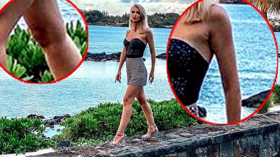 Andreea Bălan a fost bătută?! A apărut cu vânătăi suspecte pe corp
