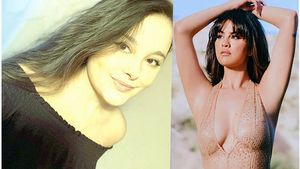 Raluca Afrăsinei a murit fulgerător din cauza unei boli rare, pe care o are și Selena Gomez. Avea 20 de ani și multe visuri de îndeplinit